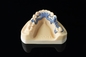 医学の歯科医療SLM 3Dプリンター調節可能な厚さのデジタル・プリンタ
