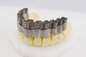 歯科宝石類工業のための単一繊維レーザー3Dの金属プリンター