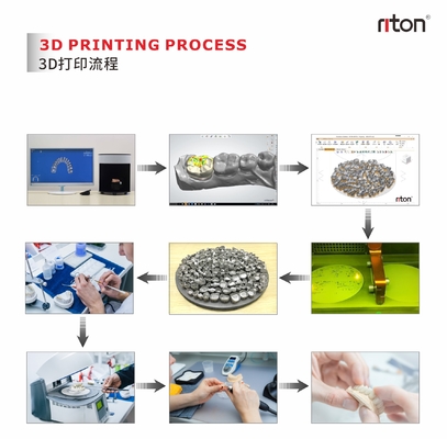 Riton M-150D 歯科工業金属3Dプリンター/添加製造機械/医療用SLMレーザー溶融機械/CNC金属加工機械