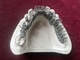 コバルトのクロムの合金歯科チタニウム3Dプリンター1停止総義歯の印刷